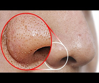 【動画】これをやってあなたの鼻の角栓をキレイに除去！